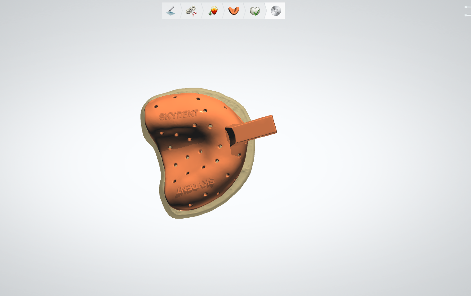 Customized Tray Example